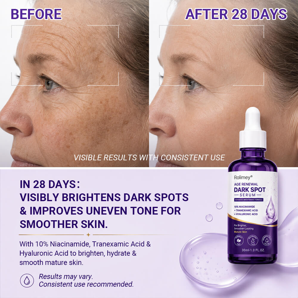 🍀 Rolimey® Age Renewal Dark Spot Serum — Infused with 10% Niacinamide, Tranexamic Acid & Hyaluronic Acid for Brighter, Smoother-Looking Mature Skin 🌼
