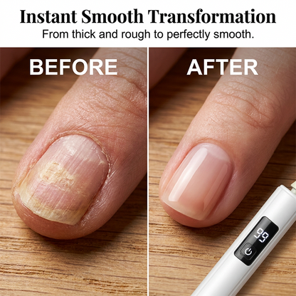 🥳2026 HOT SALE🥳💞50K+ SOLD!💅✨ 50% OFF! Professional Electric Nail Polisher – Smooths thick nails, 99-speed display. Multiple heads for shaping & buffing. Salon at home! 🌟💎